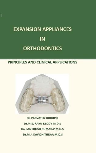 Expansion Appliance in Orthodontics