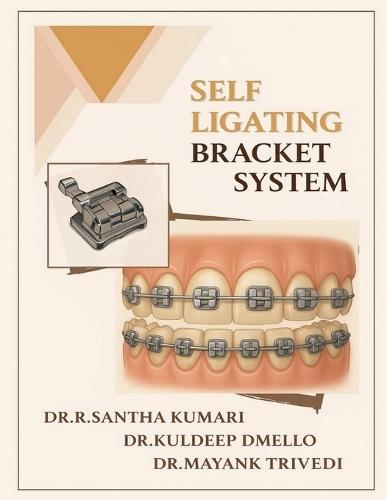 Self Ligating Bracket System