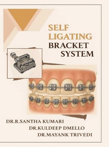 Self Ligating Bracket System