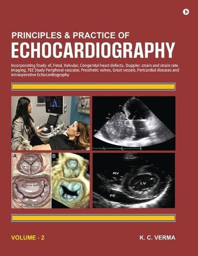 Principles and Practice of Echocardiography Volume 2