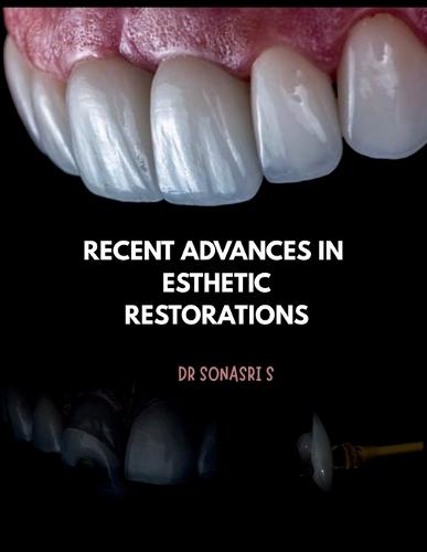 Recent Advances in Esthetic Restorations: Recent advances in direct and indirect restorations