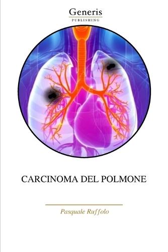Carcinoma del Polmone