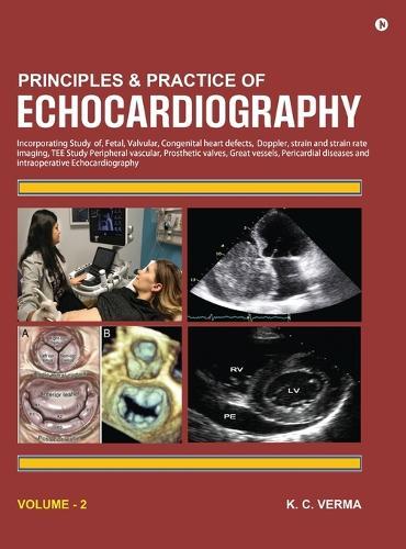 Principles and Practice of Echocardiography Volume 2