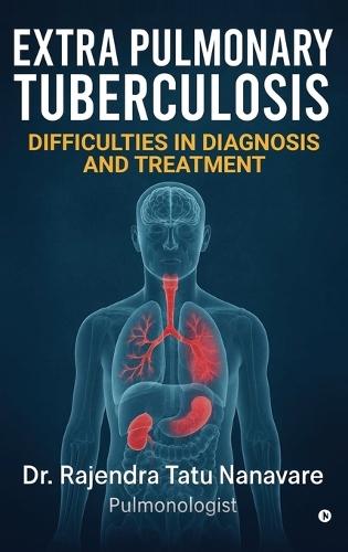 Extrapulmonary Tuberculosis Difficulties in Diagnosis and Treatment