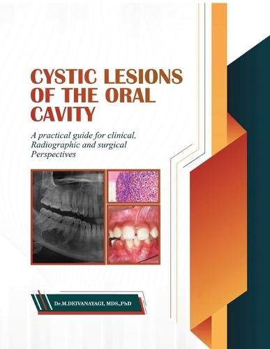 Cystic Lesions of the Oral Cavity: A Practical Guide for Clinical, Radiographic and Surgical Perspectives