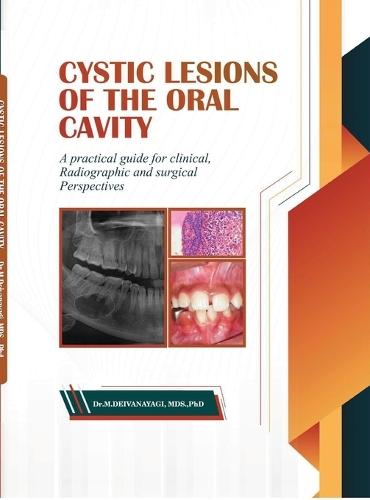 Cystic Lesions of the Oral Cavity: A Practical Guide for Clinical, Radiographic and Surgical Perspectives