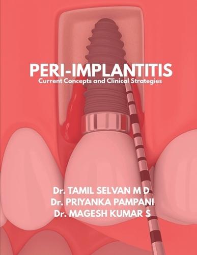Peri-Implantitis: Current Concepts and Clinical Strategies