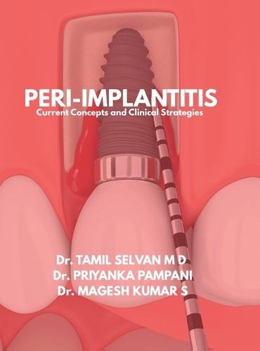 Peri-Implantitis: Current Concepts and Clinical Strategies