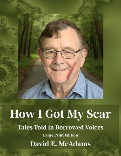 How I Got My Scar: Tales Told in Borrowed Voices