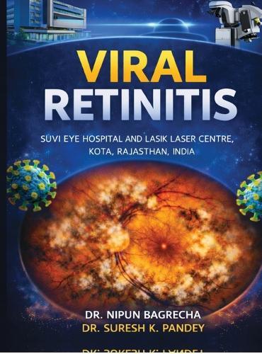 Viral Retinitis