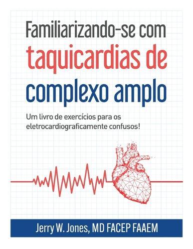 Familiarizando-se com taquicardias de complexo amplo