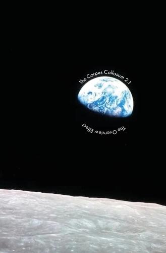 The Corpus Callosum 2.1