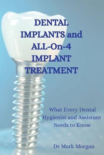 Dental Implants and All-On-4 Implant Treatment: What Every Dental Hygienist and Assistant Needs to Know
