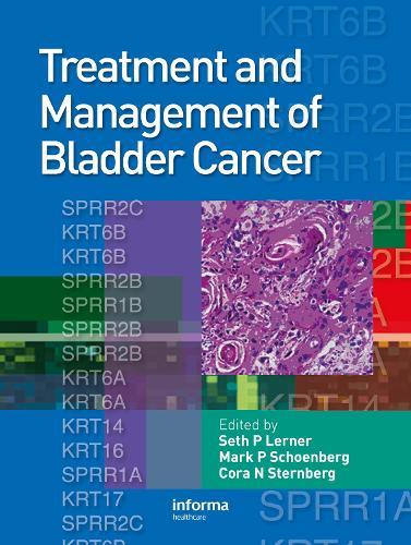 Treatment and Management of Bladder Cancer