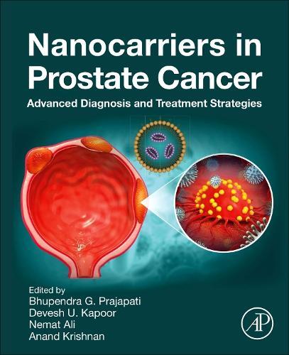 Nanocarriers in Prostate Cancer: Advanced Diagnosis and Treatment Strategies