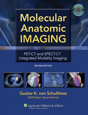 Molecular Anatomic Imaging: PET-CT and SPECT-CT Integrated Modality Imaging