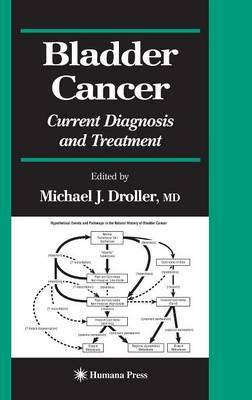 Bladder Cancer: Current Diagnosis and Treatment