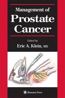 Management of Prostate Cancer