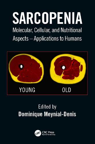 Sarcopenia: Molecular, Cellular, and Nutritional Aspects – Applications to Humans