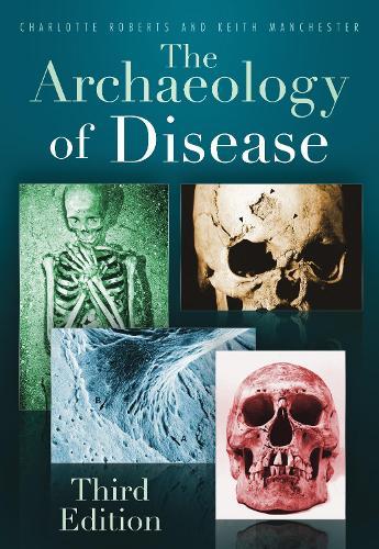 The Archaeology of Disease: Fourth Edition