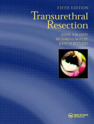 Transurethral Resection, Fifth Edition