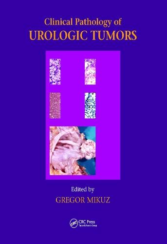 Clinical Pathology of Urological Tumours