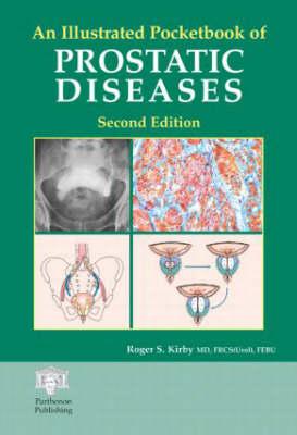 An Illustrated Pocketbook of Prostatic Disease