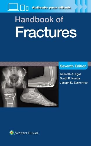 Handbook of Fractures: Print + eBook with Multimedia