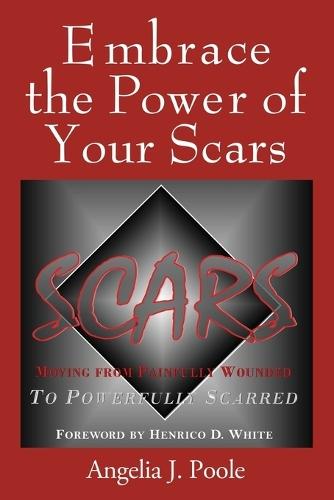 Embrace the Power of Your Scars: Moving from Painfully Wounded to Powerfully Scarred