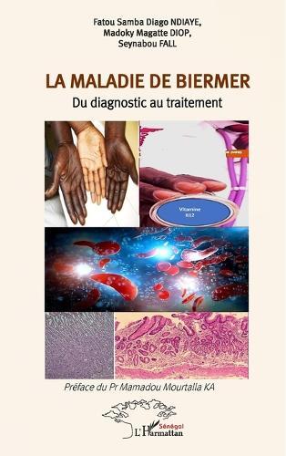 La maladie de Biermer: Du diagnostic au traitement