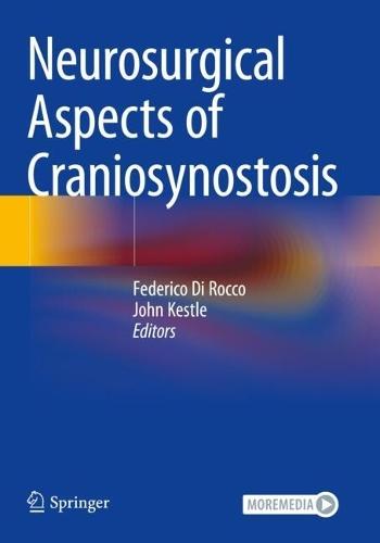 Neurosurgical Aspects of Craniosynostosis