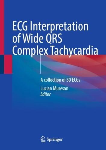 ECG Interpretation of Wide QRS Complex Tachycardia : A collection of 50 ECGs