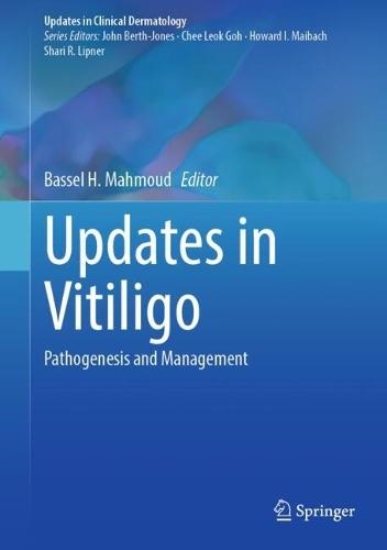 Updates in Vitiligo: Pathogenesis and Management