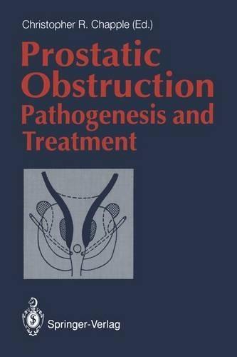 Prostatic Obstruction: Pathogenesis and Treatment