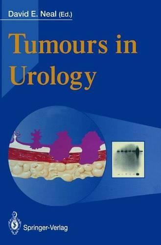 Tumours in Urology: Biology and Clinical Management