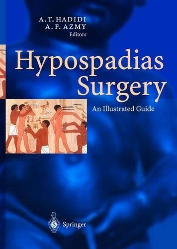 Hypospadias Surgery: An Illustrated Guide