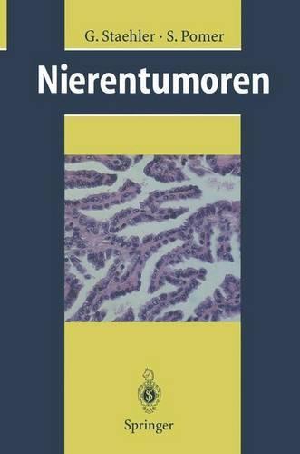 Nierentumoren: Grundlagen, Diagnostik, Therapie