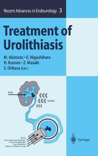 Treatment of Urolithiasis