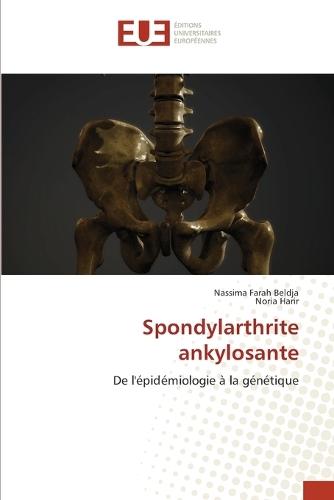 Spondylarthrite ankylosante