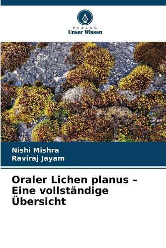 Oraler Lichen planus - Eine vollständige Übersicht