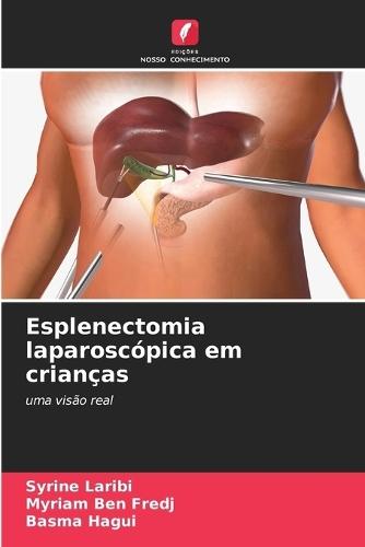 Esplenectomia laparoscópica em crianças