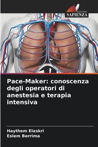 Pace-Maker: conoscenza degli operatori di anestesia e terapia intensiva