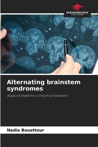 Alternating brainstem syndromes