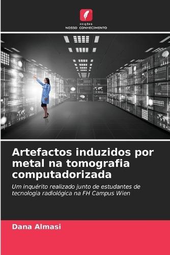 Artefactos induzidos por metal na tomografia computadorizada