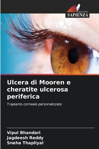 Ulcera di Mooren e cheratite ulcerosa periferica