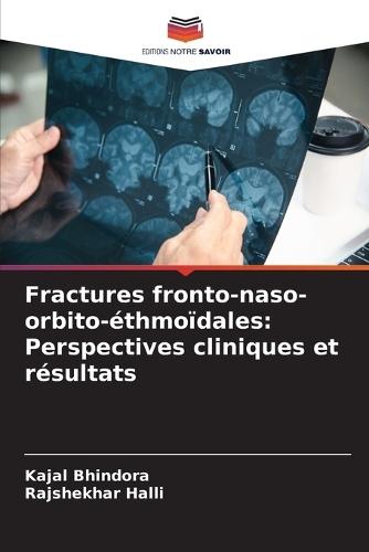Fractures fronto-naso-orbito-éthmoïdales: Perspectives cliniques et résultats