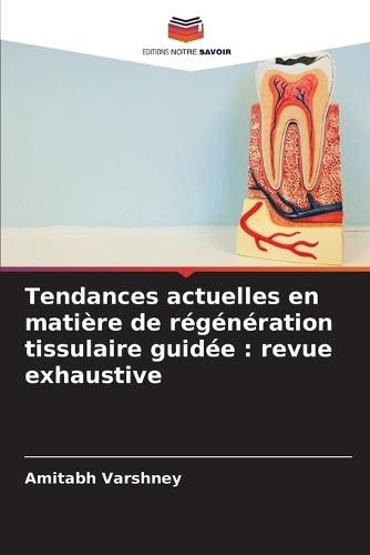 Tendances actuelles en matière de régénération tissulaire guidée: revue exhaustive