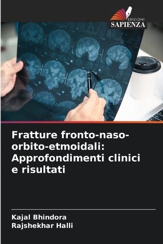 Fratture fronto-naso-orbito-etmoidali: Approfondimenti clinici e risultati