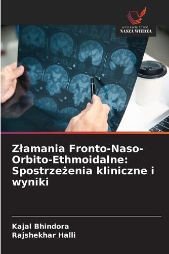 Zlamania Fronto-Naso-Orbito-Ethmoidalne: Spostrze&#380;enia kliniczne i wyniki