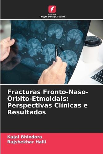 Fracturas Fronto-Naso-Órbito-Etmoidais: Perspectivas Clínicas e Resultados